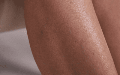How to get rid of ingrown hair